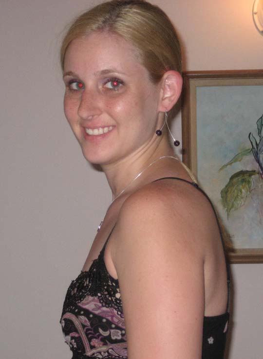 Alexis A Weisbrod